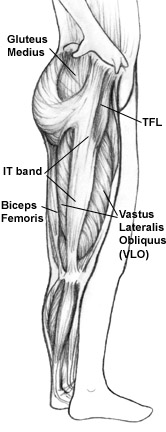 Massage therapy and injury rehab for ITT, ITB, IT band pain, Iliotibial band pain in runners, hikers, cyclists. Boulder & Broomfield therapists, Louisville, Westminster, Gunbarrel, Denver.