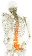 Massage therapy for scoliosis & scolitic curves. Massage therapists providing myofascial release, active release, trigger point therapy for herniated, disc, bulging disc. Boulder, Broomfield, Louisville, Westminster, Gunbarrel, Denver therapists.