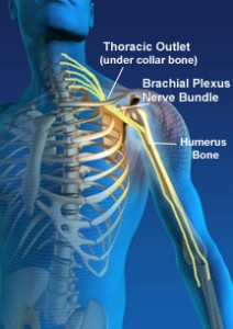 Massage therapy and injury rehab for thoracic outlet syndrome, nerve pain in your neck, arms, elbow, hand or wrist. Massage therapists in Boulder, Broomfield, Louisville, Westminster, Gunbarrel, Denver.