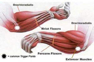 wrist flexor and extensor muscles of the forearm