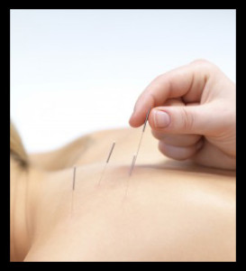 Acupuncture, Sports Acupuncture, Wellness
